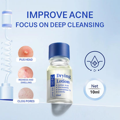 Pimple Drying Lotion 10Ml Pimple Drying Solution Zit Moisturizer Fast-Acting Facial Blemish Liquid Skin Care Anti-Acne Serum